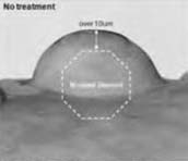 Vor Abrichten: Aufnahme mit aufgedrucktem Überstand 10 µm.